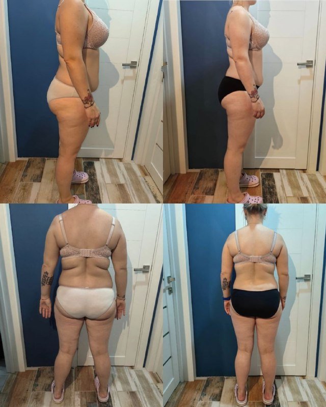 Опубликованный коллаж фотографий клиентки до и после работы над формой